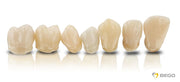 VarseoSmile® Crown plus